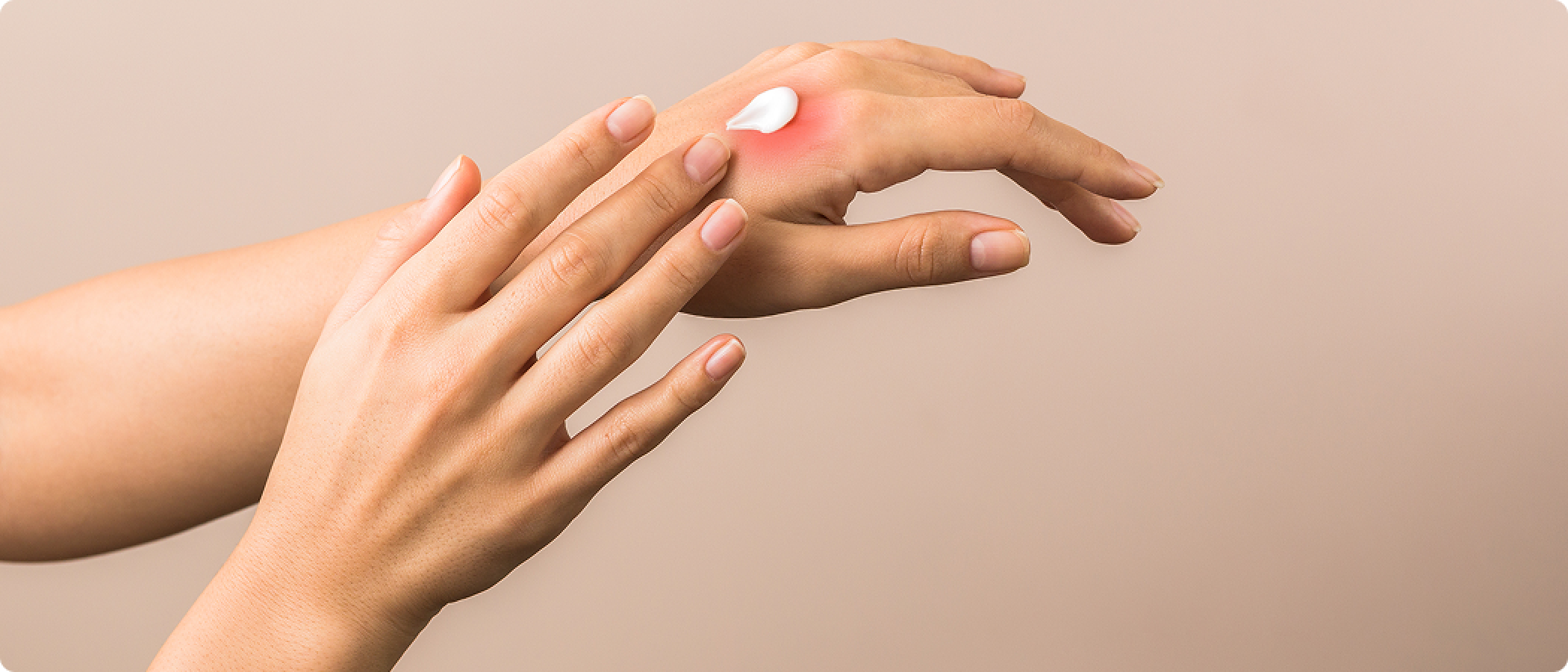 Схема терапии экземы кистей с использованием эмолентов Схема терапии экземы кистей с использованием эмолентов