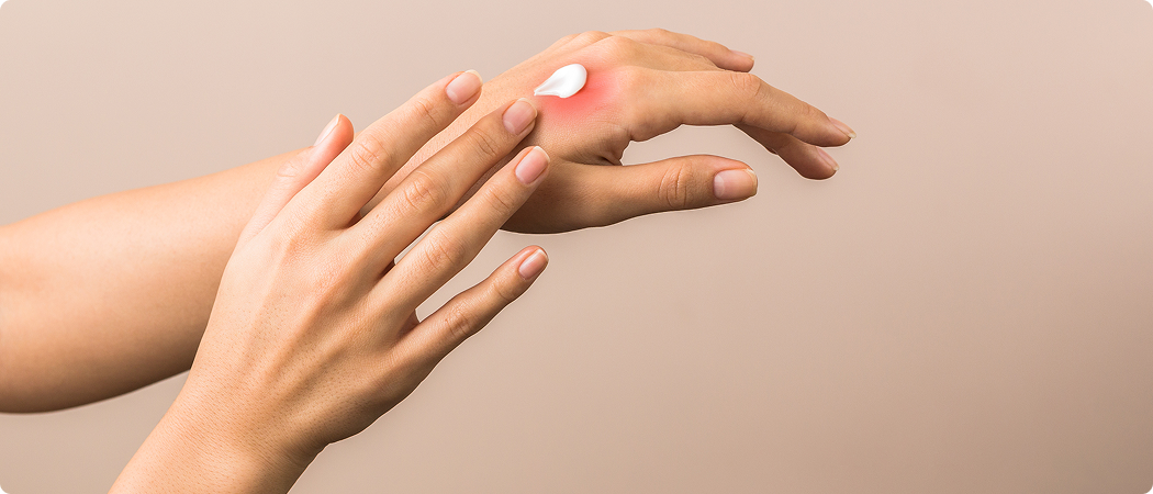 Схема терапии экземы кистей с использованием эмолентов